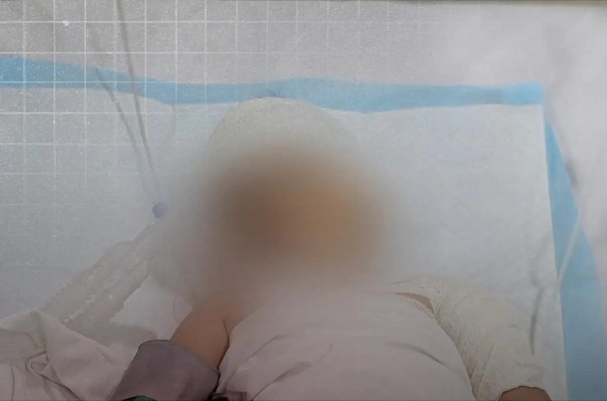 استشهاد طفل وإصابة 5 مدنيين بقصف حوثي على أحياء سكنية وسط تعز